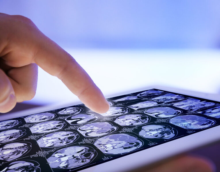 hands holding tablet displaying multiple x ray images